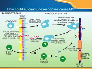 How could autoimmune responses cause MS? 