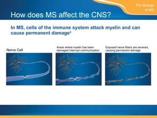 How does MS affect the CNS? In MS, cells of the immune system attack myelin and can cause permanent damage 3 The Biology of MS Areas where myelin has been damaged interrupt communication  Exposed nerve fibers are severed, causing permanent damage Nerve Cell  