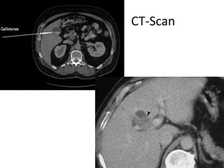 CT-Scan
 
