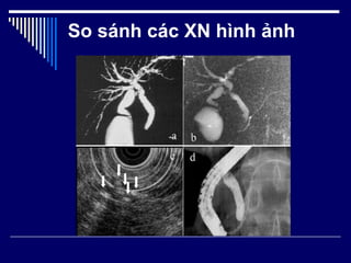 So sánh các XN hình ảnh 