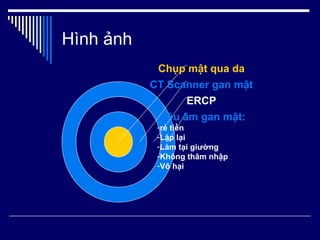 Hình ảnh Siêu âm gan mật: rẻ tiền Lặp lại Làm tại giường Không thâm nhập Vô hại ERCP CT Scanner gan mật Chụp mật qua da 