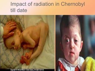 Impact of radiation in Chernobyl
till date

 