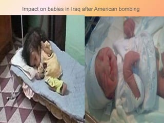 Impact on babies in Iraq after American bombing

 