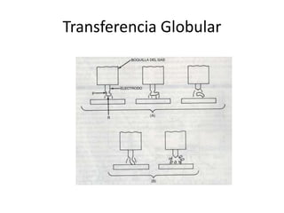 Transferencia Globular
 