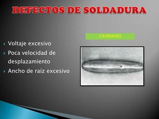 CAVIDADES
   Voltaje excesivo
   Poca velocidad de
    desplazamiento
   Ancho de raíz excesivo
 