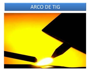 ARCO DE TIG
 