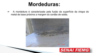 Mordeduras:
➢ A mordedura é caracterizada pela fusão da superfície da chapa do
metal de base próxima a margem do cordão de solda.
 