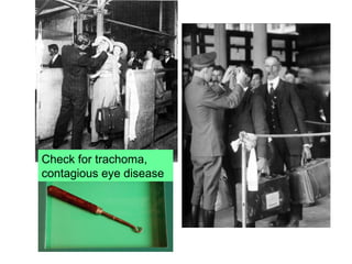 Check for trachoma,
contagious eye disease
 