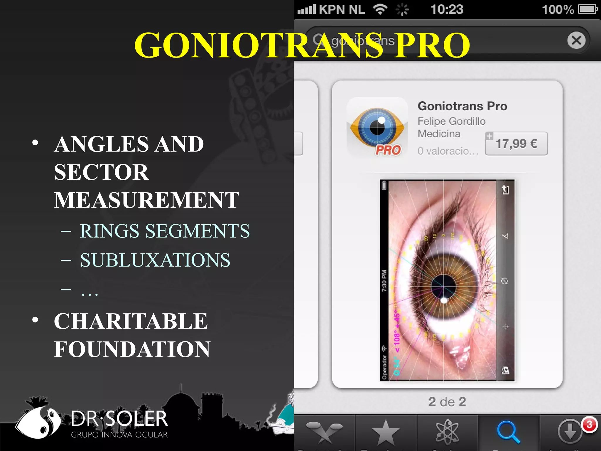 GONIOTRANS PRO
• ANGLES AND
SECTOR
MEASUREMENT
– RINGS SEGMENTS
– SUBLUXATIONS
– …

• CHARITABLE
FOUNDATION

 