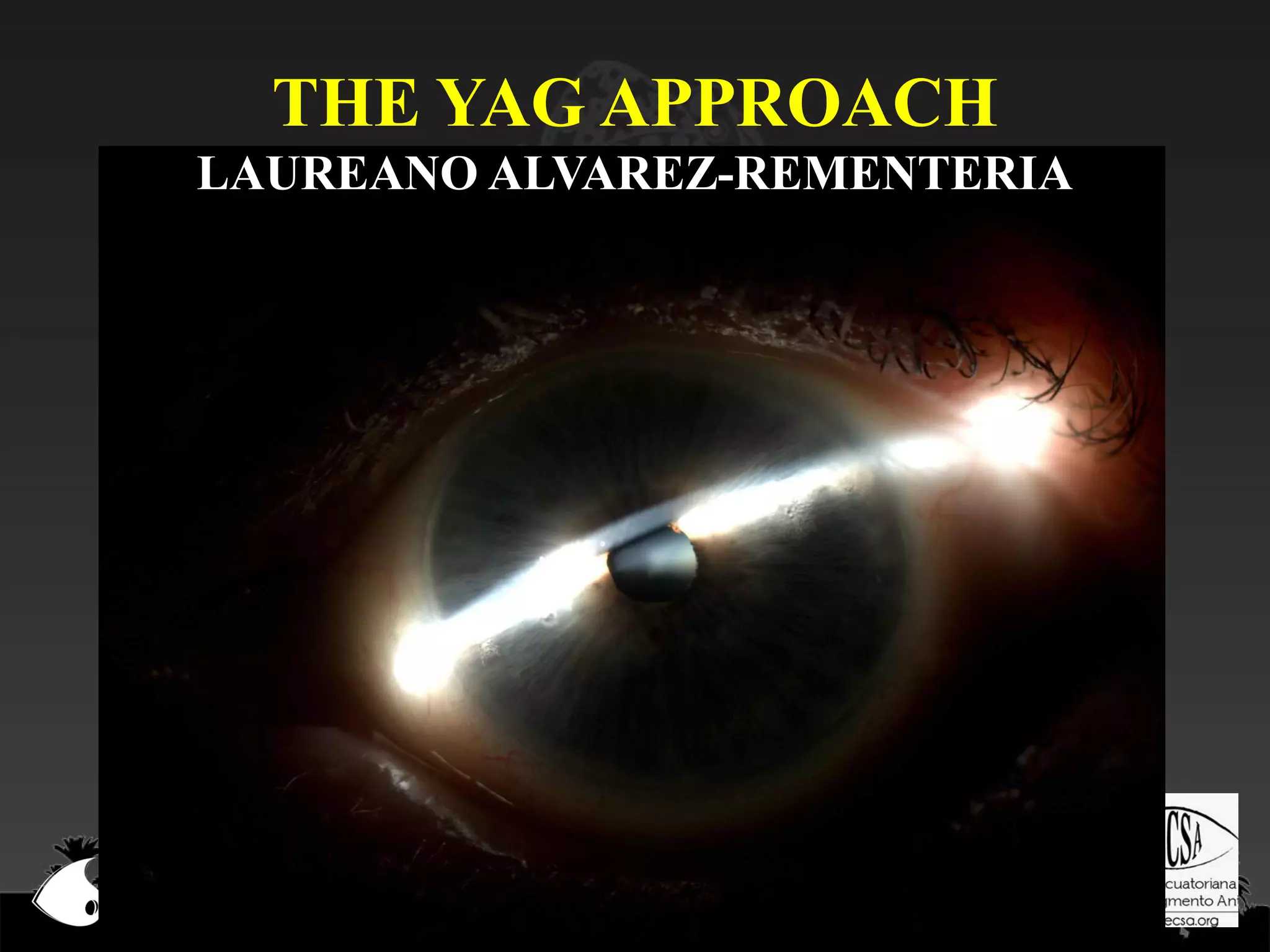 THE YAG APPROACH
LAUREANO ALVAREZ-REMENTERIA

 