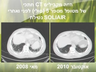 ‫חזה מקבילים ‪ CT‬חתכי‬
‫של מטופל מספר 5 )סולי( לפני ואחרי‬
‫‪ SOLIAIR‬נטילת‬

‫אוקטובר 0102‬

‫מאי 8002‬

 