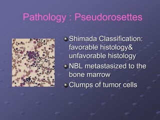 Pathology : Pseudorosettes
Shimada Classification:
favorable histology&
unfavorable histology
NBL metastasized to the
bone marrow
Clumps of tumor cells
 