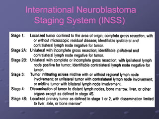 International Neuroblastoma
Staging System (INSS)
 