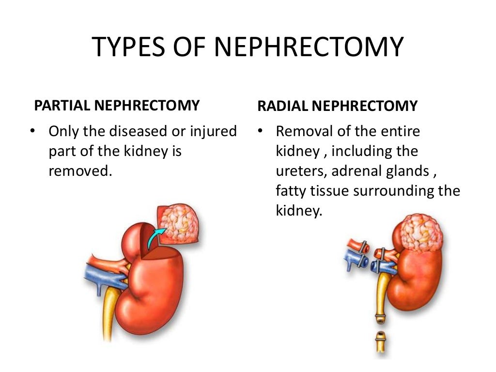 Solid organ transplantation