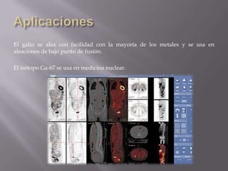 El galio se alea con facilidad con la mayoría de los metales y se usa en
aleaciones de bajo punto de fusión.
El isótopo Ga-67 se usa en medicina nuclear.

 