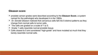 Gleason Pattern Solid SOLID TUMORS PPX PRESENTATION.pptx for education | PPTX