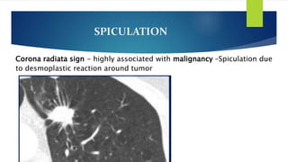 Spiculation Sign SOLITARY PULMONARY NODULE.pptx
