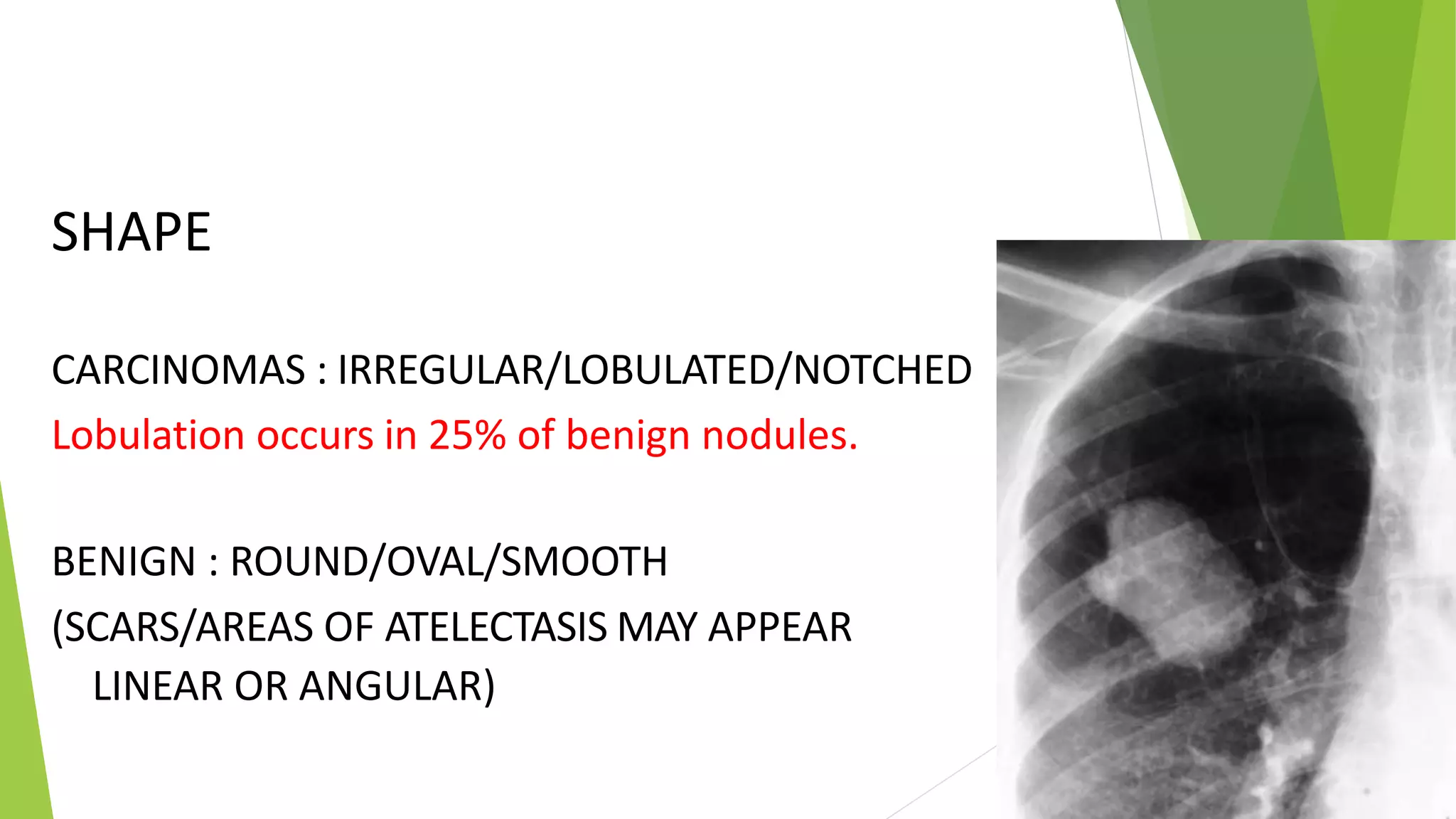 Solitary pulmonary nodules radiology pk ppt | PPTX