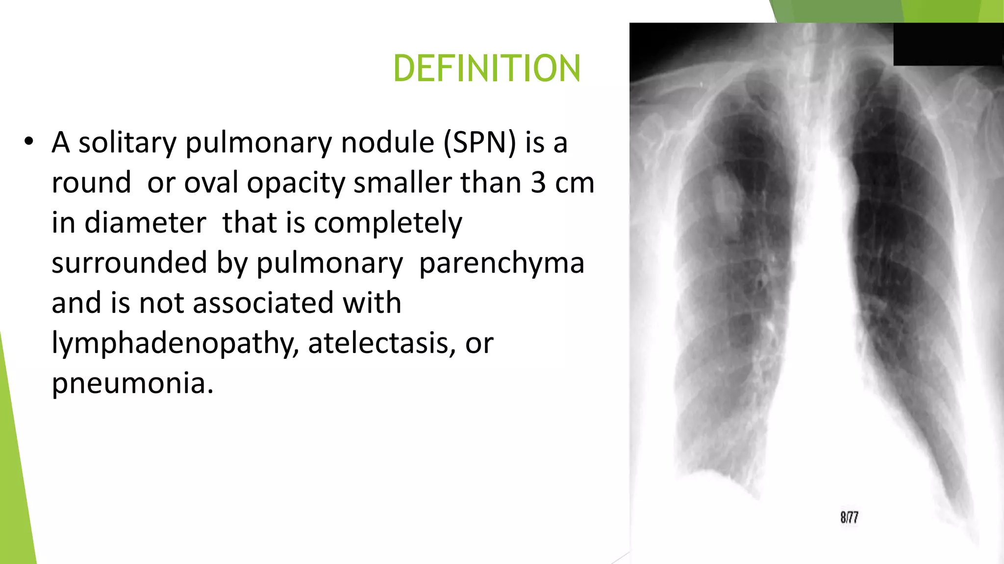 Solitary pulmonary nodules radiology pk ppt | PPTX