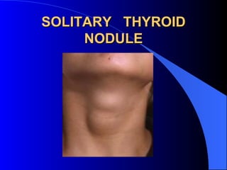 SOLITARY THYROID
     NODULE
 