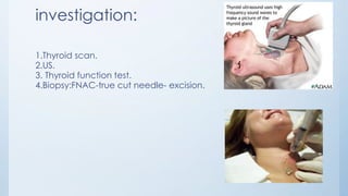 investigation:
1.Thyroid scan.
2.US.
3. Thyroid function test.
4.Biopsy:FNAC-true cut needle- excision.
 
