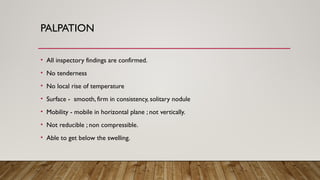 PALPATION
• All inspectory findings are confirmed.
• No tenderness
• No local rise of temperature
• Surface - smooth, firm in consistency, solitary nodule
• Mobility - mobile in horizontal plane ; not vertically.
• Not reducible ; non compressible.
• Able to get below the swelling.
 