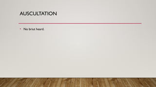 AUSCULTATION
• No briut heard.
 