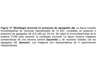 Figura 17.   Morfología neuronal en presencia de agregados Aβ.  La figura muestra m icrofotografías de neuronas hipocampales de 12 DIV, incubadas en ausencia o presencia de agregados Aβ (0.5 μM) por 24 hrs. Se utilizó la inmunoreactividad de la proteína P-220 para observar la morfología neuronal. La figura muestra imágenes características de una neurona control ( izquierda ) y de neuronas tratadas con los agregados Aβ ( derecha ). Las imágenes son representativas de 4 experimentos independientes.  