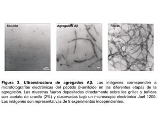 Figura 2.   Ultraestructura  de agregados Aβ.  Las imágenes corresponden a  microfotografías electrónicas del péptido  β -amiloide en las diferentes etapas de la agregación. Las muestras fueron depositadas directamente sobre las grillas y teñidas con acetato de uranilo (2%) y observadas bajo un microscopio electrónico Joel 1200. Las imágenes son representativas de 9 experimentos independientes. Soluble 50 nm Agregados   Aβ   Fibras 