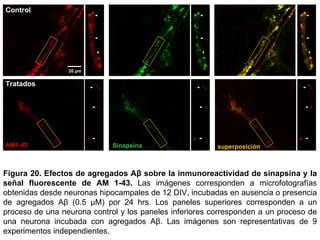 Figura 20.   Efectos de   agregados Aβ   sobre la inmunoreactividad de sinapsina y la señal fluorescente de AM 1-43.  Las imágenes corresponden a  microfotografías obtenidas desde neuronas hipocampales de 12 DIV, incubadas en ausencia o presencia de agregados A β  (0.5  µM) por 24 hrs.  Los paneles superiores corresponden a un proceso de una neurona control y los paneles inferiores corresponden a un proceso de una neurona incubada con agregados Aβ .  Las imágenes son representativas de 9 experimentos independientes. AM1-43 Sinapsina superposición Tratados Control 20  µm 