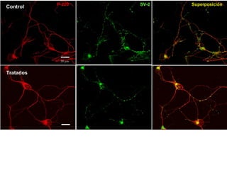 20  µm P-220 SV-2 Tratados Control Superposición 