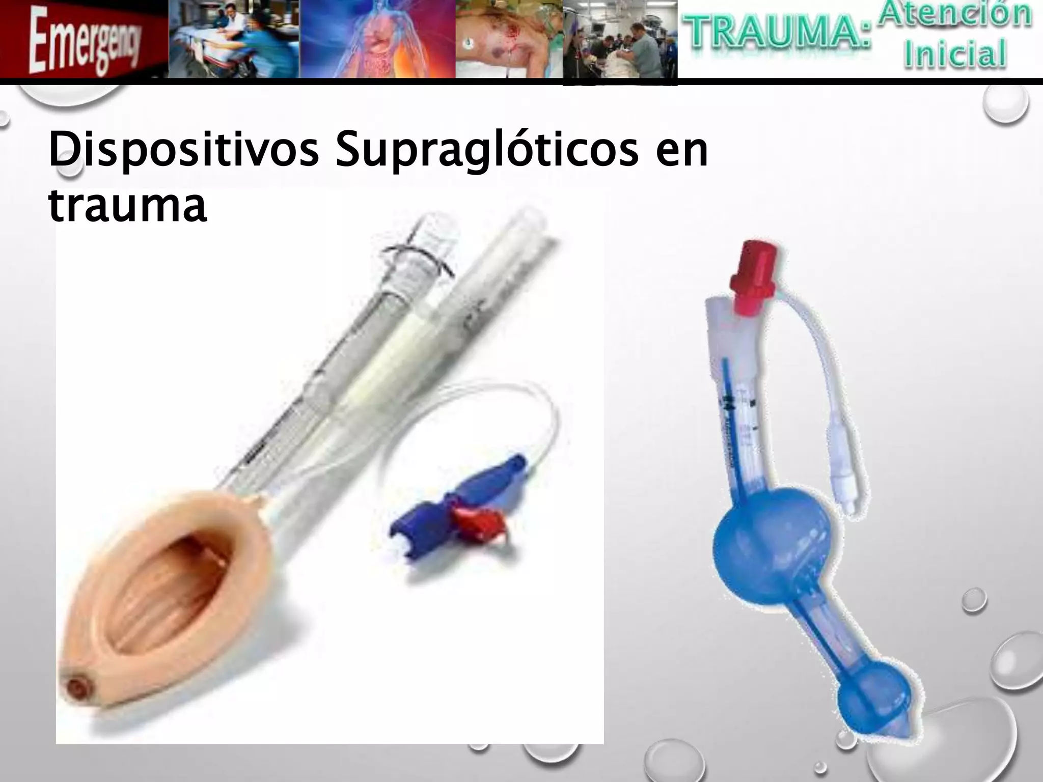 Dispositivos Supraglóticos en
trauma
