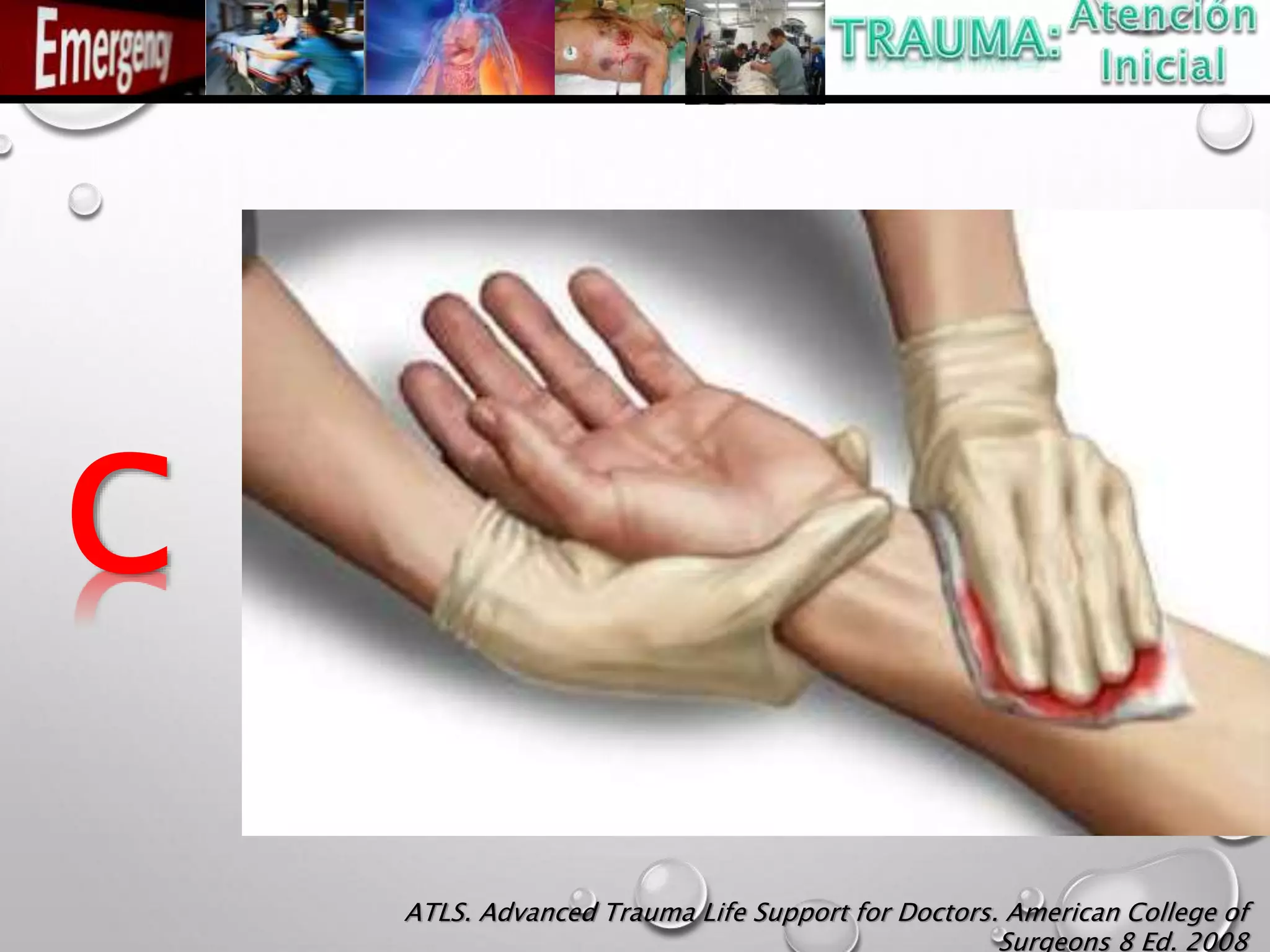 C
ATLS. Advanced Trauma Life Support for Doctors. American College of
Surgeons 8 Ed. 2008