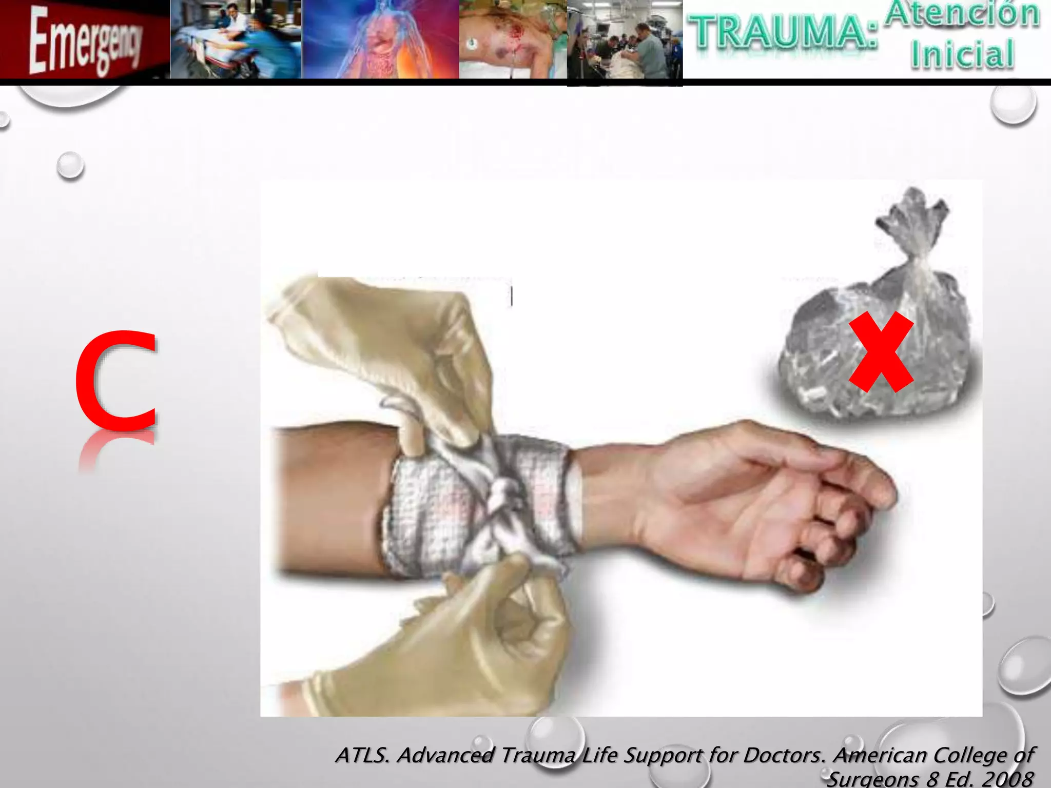 C
ATLS. Advanced Trauma Life Support for Doctors. American College of
Surgeons 8 Ed. 2008