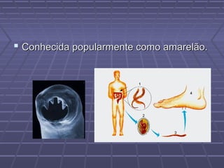  Conhecida popularmente como amarelão.
 
