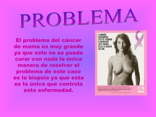 El problema del cáncer de mama es muy grande ya que este no se puede curar con nada la única manera de resolver el problema de este caso es la biopsia ya que esta es la única que controla esta enfermedad. PROBLEMA 