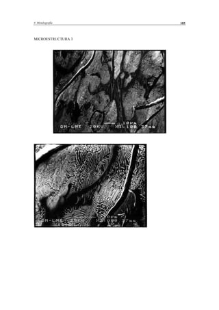 6 Metalografía 105
MICROESTRUCTURA 3
 