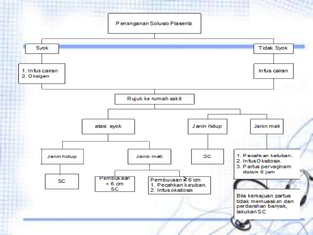 askep solusio plasenta pdf askep solusio plasenta pdf