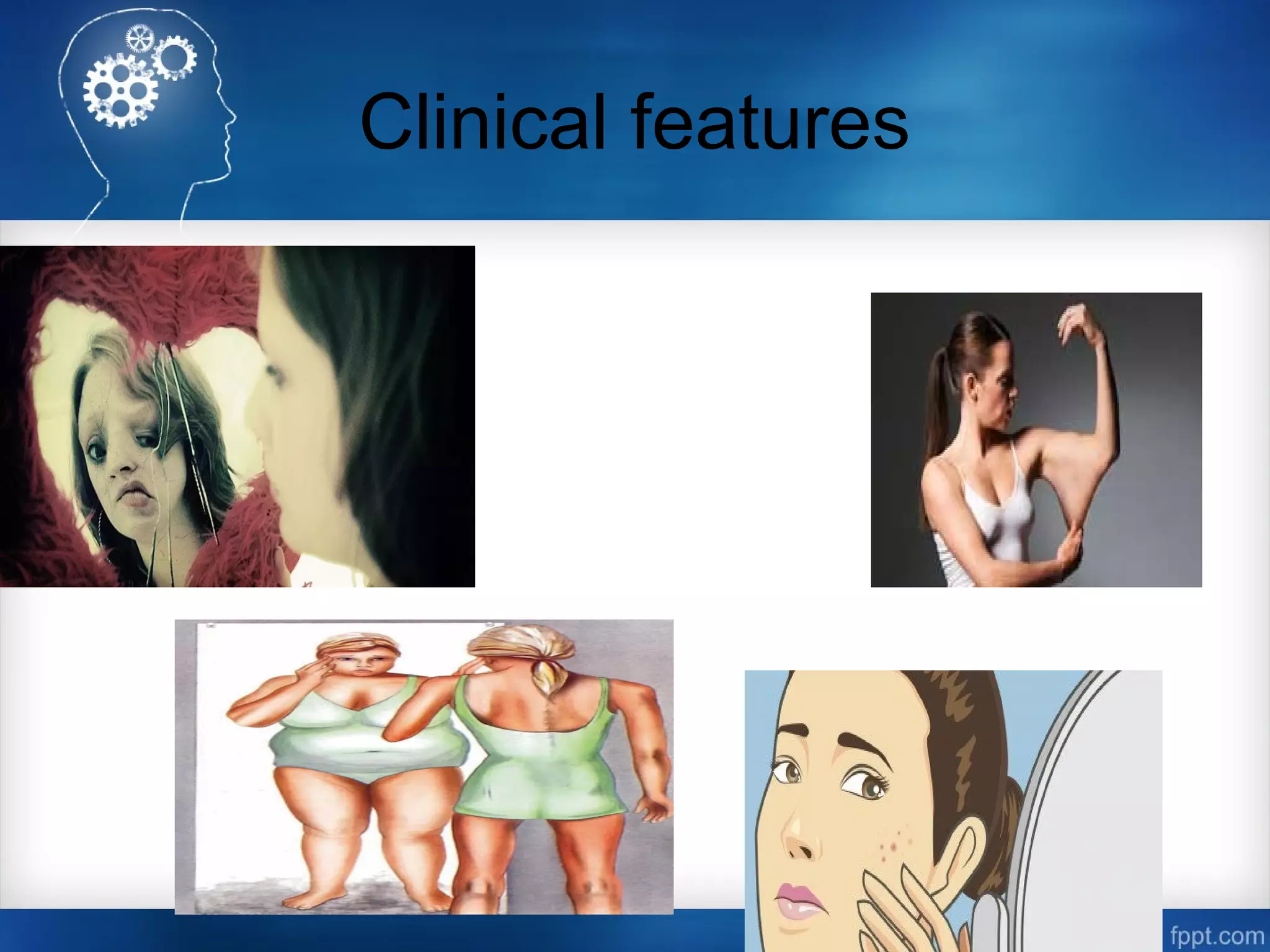 Clinical features
 