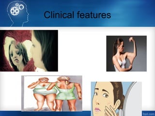 Clinical features
 