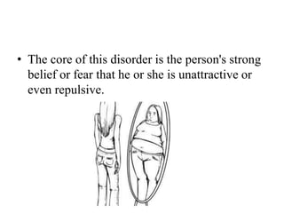 • The core of this disorder is the person's strong
belief or fear that he or she is unattractive or
even repulsive.
 