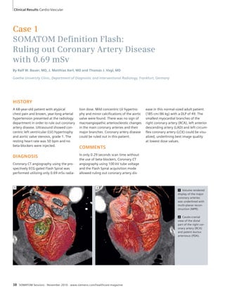 Clinical Results Cardio-Vascular 
Case 1 
SOMATOM Defi nition Flash: 
Ruling out Coronary Artery Disease 
with 0.69 mSv 
By Ralf W. Bauer, MD, J. Matthias Kerl, MD and Thomas J. Vogl, MD 
Goethe University Clinic, Department of Diagnostic and Interventional Radiology, Frankfurt, Germany 
HISTORY 
A 68-year-old patient with atypical 
chest pain and known, year-long arterial 
hypertension presented at the radiology 
department in order to rule out coronary 
artery disease. Ultrasound showed con-centric 
left ventricular (LV) hypertrophy 
and aortic valve stenosis, grade 1. The 
resting heart rate was 50 bpm and no 
beta-blockers were injected. 
DIAGNOSIS 
Coronary CT angiography using the pro-spectively 
ECG-gated Flash Spiral was 
performed utilizing only 0.69 mSv radia-tion 
dose. Mild concentric LV hypertro-phy 
and minor calcifications of the aortic 
valve were found. There was no sign of 
macroangiopathic arteriosclerotic changes 
in the main coronary arteries and their 
major branches. Coronary artery disease 
could be ruled out in this patient. 
COMMENTS 
In only 0.29 seconds scan time without 
the use of beta-blockers, Coronary CT 
angiography using 100 kV tube voltage 
and the Flash Spiral acquisition mode 
allowed ruling out coronary artery dis-ease 
38 SOMATOM Sessions · November 2010 · www.siemens.com/healthcare-magazine 
1 Volume rendered 
display of the major 
coronary arteries 
was underlined with 
multi-planar recon-struction 
(MPR). 
2 Caudo-cranial 
view of the distal 
part of the right cor-onary 
artery (RCA) 
and patent ductus 
arteriosus (PDA). 
1 2 
in this normal-sized adult patient 
(185 cm / 86 kg) with a DLP of 49. The 
smallest myocardial branches of the 
right coronary artery (RCA), left anterior 
descending artery (LAD) and left circum-flex 
coronary artery (LCX) could be visu-alized, 
underlining best image quality 
at lowest dose values. 
 