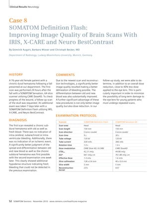 Case 8 
SOMATOM Defi nition Flash: 
Improving Image Quality of Brain Scans With 
IRIS, X-CARE and Neuro BestContrast 
By Dominik Augart, Barbara Wieser and Christoph Becker, MD 
Department of Radiology, Ludwig-Maximilians-University, Munich, Germany 
COMMENTS 
Due to the newest scan and reconstruc-tion 
technologies, a significantly better 
image quality resulted making a better 
delineation of bleeding possible. The 
differentiation between old and new 
blood was also substantially improved. 
A further significant advantage of these 
new procedures is not only better image 
quality but also dose reduction. In our 
EXAMINATION PROTOCOL 
Scanner SOMATOM Definition Flash SOMATOM Sensation 64 
Scan area Head Head 
Scan length 150 mm 150 mm 
Scan direction Cranio-caudal Cranio-caudal 
Scan time 9 s 30 s 
Tube voltage 120 kV 120 kV 
Tube current 320 mAs 306 mAs 
Rotation time 1.0 s 1.0 s 
Dose modulation CARE Dose 4D, X-CARE CARE Dose4D 
CTDIvol 42.21 mGy 49.80 mGy 
DLP 661 mGy cm 761,88 mGy cm 
Effective Dose 1.4 mSv 1.6 mSv 
Slice collimation 128 x 0.6 mm 40 x 0.6 mm 
Slice width 5 mm 5 mm 
Reconstruction 
J37s H37 
kernel 
HISTORY 
A 76-year-old female patient with a 
chronic dural hematoma following a fall 
presented at our department. The first 
scan was performed 24 hours after the 
fall with a SOMATOM Sensation, 64-slice 
scanner utilizing CARE Dose4D. To check 
progress of the wound, a follow-up scan 
of the skull was requested. An additional 
exam was taken 7 days later with a 
SOMATOM Definition Flash utilizing IRIS, 
X-CARE, and Neuro BestContrast. 
DIAGNOSIS 
The first scan revealed a chronic sub-dural 
hematoma with old as well as 
fresh blood. There was no indication of 
intra-cerebral, subarachnoid or intra-ventricular 
bleeding. Additionally, there 
was no indication of an ischemic event. 
A significantly better judgment of the 
spread and differentiation between old 
and new blood as well as the chronic 
subdural hematoma was first possible 
with the second examination one week 
later. This clearly showed additional 
hypodense structure indicating fresh 
bleeding that could not be detected in 
the previous examination. 
52 SOMATOM Sessions · November 2010 · www.siemens.com/healthcare-magazine 
follow-up study, we were able to de - 
termine, in addition to an overall dose 
reduction, close to 40% less dose 
applied to the eye lens. This is parti-cularly 
important in order to minimize 
the possibility of long-term damage to 
the eye lens for young patients who 
must undergo repeated scans. 
Clinical Results Neurology 
 
