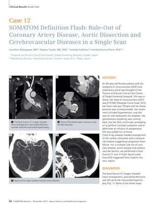 Clinical Results Acute Care 
Case 12 
SOMATOM Defi nition Flash: Rule-Out of 
Coronary Artery Disease, Aortic Dissection and 
Cerebrovascular Diseases in a Single Scan 
Junichiro Nakagawa, MD,* Osamu Tasaki, MD, PhD,* Tomoko Fujihara**and Katharina Otani, PhD** 
*Trauma and Acute Critical Care Center, Osaka University Hospital, Osaka, Japan 
**Marketing Division, Healthcare Sector, Siemens Japan K.K., Tokyo, Japan 
3A 3B 
60 SOMATOM Sessions · November 2010 · www.siemens.com/healthcare-magazine 
HISTORY 
An 89-year-old female patient with dis-turbance 
of consciousness (DOC) and 
respiratory arrest was brought to the 
Trauma and Acute Critical Care Center 
of Osaka University Hospital. She was in 
shock, her level of consciousness (LOC) 
was E1V1M2 (Glasgow Coma Scale, GCS) 
her heart rate was 74 bpm and her blood 
pressure was unmeasureable. Her anam-nesis 
included hypertension, and she 
was on oral medication for diabetes. Her 
spontaneous breathing was coming 
back, but her DOC continued, prompting 
us to perform tracheal intubation and to 
administer an infusion of vasopressors. 
She was pulled out of shock. 
Chest X-ray showed marked enlargement 
of the cardiac silhouette and a mediasti-nal 
shadow suggesting congestive heart 
failure. For a multiple rule-out of coro-nary 
disease, aortic disease and cerebro-vascular 
lesions, we performed a Dual 
Source CT scan in Flash Spiral mode 
(non-ECG-triggered) from head to tho-racic 
region. 
DIAGNOSIS 
The Dual Source CT images showed 
heart enlargement, pericardial effusions 
and left ventricle myocardial hypertro-phy 
(Fig. 1). None of the three major 
1 The Dual Source CT images showed 
heart enlargement, pericardial effusions 
and left ventricle myocardial hypertrophy. 
1 
2 None of the three major coronary arter-ies 
had stenoses. 
2 
3 None of the major cerebral arteries were affected. 
 