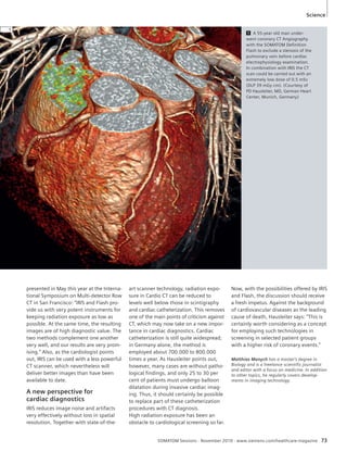 1 A 55-year old man under-went 
coronary CT Angiography 
with the SOMATOM Definition 
Flash to exclude a stenosis of the 
pulmonary vein before cardiac 
electrophysiology examination. 
In combination with IRIS the CT 
scan could be carried out with an 
extremely low dose of 0.5 mSv 
(DLP 39 mGy cm). (Courtesy of 
PD Hausleiter, MD, German Heart 
Center, Munich, Germany) 
SOMATOM Sessions · November 2010 · www.siemens.com/healthcare-magazine 73 
presented in May this year at the Interna-tional 
Symposium on Multi-detector Row 
CT in San Francisco: “IRIS and Flash pro-vide 
us with very potent instruments for 
keeping radiation exposure as low as 
possible. At the same time, the resulting 
images are of high diagnostic value. The 
two methods complement one another 
very well, and our results are very prom-ising.” 
Also, as the cardiologist points 
out, IRIS can be used with a less powerful 
CT scanner, which nevertheless will 
deliver better images than have been 
available to date. 
A new perspective for 
cardiac diagnostics 
IRIS reduces image noise and artifacts 
very effectively without loss in spatial 
resolution. Together with state-of-the-art 
scanner technology, radiation expo-sure 
in Cardio CT can be reduced to 
levels well below those in scintigraphy 
and cardiac catheterization. This removes 
one of the main points of criticism against 
CT, which may now take on a new impor-tance 
in cardiac diagnostics. Cardiac 
catheterization is still quite widespread; 
in Germany alone, the method is 
employed about 700.000 to 800.000 
times a year. As Hausleiter points out, 
however, many cases are without patho-logical 
findings, and only 25 to 30 per 
cent of patients must undergo balloon 
dilatation during invasive cardiac imag-ing. 
Thus, it should certainly be possible 
to replace part of these catheterization 
procedures with CT diagnosis. 
High radiation exposure has been an 
obstacle to cardiological screening so far. 
Now, with the possibilities offered by IRIS 
and Flash, the discussion should receive 
a fresh impetus. Against the background 
of cardiovascular diseases as the leading 
cause of death, Hausleiter says: “This is 
certainly worth considering as a concept 
for employing such technologies in 
screening in selected patient groups 
with a higher risk of coronary events.” 
Matthias Manych has a master’s degree in 
Biology and is a freelance scientific journalist 
and editor with a focus on medicine. In addition 
to other topics, he regularly covers develop-ments 
in imaging technology. 
1 
Science 
 