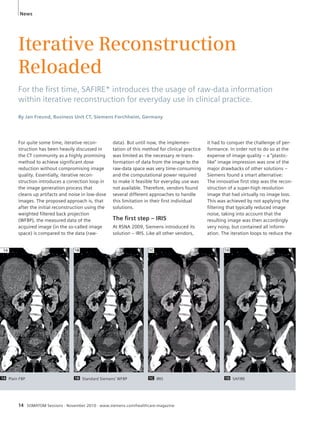 News 
Iterative Reconstruction 
Reloaded 
For the fi rst time, SAFIRE* introduces the usage of raw-data information 
within iterative reconstruction for everyday use in clinical practice. 
By Jan Freund, Business Unit CT, Siemens Forchheim, Germany 
For quite some time, iterative recon-struction 
has been heavily discussed in 
the CT community as a highly promising 
method to achieve significant dose 
reduction without compromising image 
quality. Essentially, iterative recon-struction 
introduces a correction loop in 
the image generation process that 
cleans up artifacts and noise in low-dose 
images. The proposed approach is, that 
after the initial reconstruction using the 
weighted filtered back projection 
(WFBP), the measured data of the 
acquired image (in the so-called image 
space) is compared to the data (raw-it 
1A 1B 1C 1D 
14 SOMATOM Sessions · November 2010 · www.siemens.com/healthcare-magazine 
had to conquer the challenge of per-formance. 
In order not to do so at the 
expense of image quality – a “plastic-like” 
image impression was one of the 
major drawbacks of other solutions – 
Siemens found a smart alternative: 
The innovative first step was the recon-struction 
of a super-high resolution 
image that had virtually no image loss. 
This was achieved by not applying the 
filtering that typically reduced image 
noise, taking into account that the 
resulting image was then accordingly 
very noisy, but contained all inform-ation. 
The iteration loops to reduce the 
data). But until now, the implemen-tation 
of this method for clinical practice 
was limited as the necessary re-trans-formation 
of data from the image to the 
raw-data space was very time-consuming 
and the computational power required 
to make it feasible for everyday use was 
not available. Therefore, vendors found 
several different approaches to handle 
this limitation in their first individual 
solutions. 
The fi rst step – IRIS 
At RSNA 2009, Siemens introduced its 
solution – IRIS. Like all other vendors, 
1A Plain FBP 1B Standard Siemens’ WFBP 1C IRIS 1D SAFIRE 
 