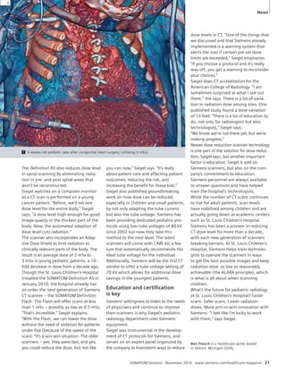 SOMATOM Sessions · November 2010 · www.siemens.com/healthcare-magazine 21 
The Definition AS also reduces dose level 
in spiral scanning by eliminating radia-tion 
in pre- and post-spiral areas that 
won’t be reconstructed. 
Siegel watches on a computer monitor 
as a CT scan is performed on a young 
cancer patient. “Before, we’d set one 
dose level for the entire body,” Siegel 
says, “a dose level high enough for good 
image quality in the thickest part of the 
body. Now, the automated adaption of 
dose level cuts radiation.” 
The scanner also incorporates an Adap-tive 
Dose Shield to limit radiation to 
cli nically relevant parts of the body. The 
result is an average dose of 2 mSv to 
3 mSv in young pediatric patients, a 10- 
fold decrease in dose from a decade ago. 
Though the St. Louis Children’s Hospital 
installed the SOMATOM Definition AS in 
January 2010, the hospital already has 
on order the next generation of Siemens 
CT scanner – the SOMATOM Definition 
Flash. The Flash will offer scans at less 
than 1 mSv – possibly as low as 0.5 mSv. 
“That’s incredible,” Siegel explains. 
“With the Flash, we can lower the dose 
without the need of sedation for patients 
under five (because of the speed of the 
scan). “It’s a win-win situation. The older 
scanners – yes, they were fast, and yes, 
you could reduce the dose, but not like 
you can now,” Siegel says. “It’s really 
about patient care and affecting patient 
outcomes, reducing the risk, and 
in creasing the benefit for these kids.” 
Siegel also published groundbreaking 
work on how dose can be reduced, 
especially in children and small patients, 
by not only adapting the tube current 
but also the tube voltage. Siemens has 
been providing dedicated pediatric pro-tocols 
using low tube voltages of 80 kV 
since 2002 but now they take this 
method to the next level. The latest 
scanners will come with CARE kV, a fea-ture 
that automatically recommends the 
ideal tube voltage for the individual. 
Additionally, Siemens will be the first CT 
vendor to offer a tube voltage setting of 
70 kV which allows for additional dose 
savings in the youngest patients. 
Education and certifi cation 
is key 
Siemens’ willingness to listen to the needs 
of physicians and continue to improve 
their scanners is why Siegel’s pediatric 
radiology department uses Siemens 
equipment. 
Siegel was instrumental in the develop-ment 
of CT protocols for Siemens, and 
serves on an expert panel organized by 
the company to brainstorm ways to reduce 
dose levels in CT. “One of the things that 
we discussed and that Siemens already 
implemented is a warning system that 
alerts the user if certain pre-set dose 
limits are exceeded,” Siegel emphazies. 
“If you choose a protocol and it’s really 
way off, you get a warning to reconsider 
your choices.” 
Siegel does CT accreditation for the 
American College of Radiology. “I am 
sometimes surprised at what I see out 
there,” she says. There is a lot of varia-tion 
in radiation dose among sites. One 
published study found a dose variation 
of 13-fold. “There is a lot of education to 
do, not only for radiologists but also 
technologists,” Siegel says. 
“We know we’re not there yet, but we’re 
making progress.” 
Newer dose reduction scanner technology 
is one part of the solution for dose reduc-tion, 
Siegel says, but another important 
factor is education. Siegel is sold on 
Siemens scanners, but also on the com-pany’s 
commitment to education. 
Siemens personnel are always available 
to answer questions and have helped 
train the hospital’s technologists. 
While the number of CT scans continues 
to rise for adult patients, scan levels 
have stabilized among children and are 
actually going down at academic centers 
such as St. Louis Children’s Hospital. 
Siemens has been a pioneer in reducing 
CT dose level for more than a decade, 
with each new generation of scanners 
breaking barriers. At St. Louis Children’s 
Hospital, Siemens helps train technolo-gists 
to operate the scanners in ways 
to get the best possible images and keep 
radiation dose as low as reasonably 
achievable (the ALARA principle), which 
is what is all about when scanning 
children. 
What’s the future for pediatric radiology 
at St. Louis Children’s Hospital? Faster 
scans. Safer scans. Lower radiation 
doses. More arm-in-arm innovation with 
Siemens. “I feel like I’m lucky to work 
with them,” says Siegel. 
Ron French is a healthcare writer based 
in Detroit, Michigan (USA). 
1 6 weeks old pediatic case after congenital heart surgery (utilizing 3 mSv) 
1 
News 
 
