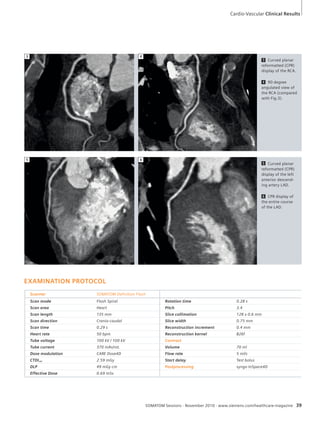 Cardio-Vascular Clinical Results 
3 Curved planar 
reformatted (CPR) 
display of the RCA. 
4 90 degree 
angulated view of 
the RCA (compared 
with Fig.3). 
5 Curved planar 
reformatted (CPR) 
display of the left 
anterior descend-ing 
SOMATOM Sessions · November 2010 · www.siemens.com/healthcare-magazine 39 
3 4 
EXAMINATION PROTOCOL 
Scanner SOMATOM Definition Flash 
Scan mode Flash Spiral Rotation time 0.28 s 
Scan area Heart Pitch 3.4 
Scan length 135 mm Slice collimation 128 x 0.6 mm 
Scan direction Cranio-caudal Slice width 0.75 mm 
Scan time 0.29 s Reconstruction increment 0.4 mm 
Heart rate 50 bpm Reconstruction kernel B26f 
Tube voltage 100 kV / 100 kV Contrast 
Tube current 370 mAs/rot. Volume 70 ml 
Dose modulation CARE Dose4D Flow rate 5 ml/s 
CTDIvol 2.59 mGy Start delay Test bolus 
DLP 49 mGy cm Postprocessing syngo InSpace4D 
Effective Dose 0.69 mSv 
artery LAD. 
6 CPR display of 
the entire course 
of the LAD. 
5 6 
 