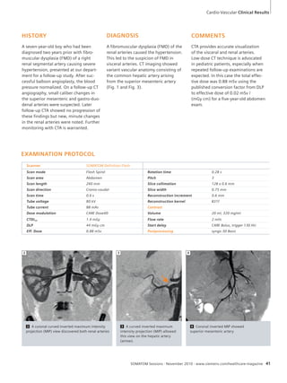 DIAGNOSIS 
A fibromuscular dysplasia (FMD) of the 
renal arteries caused the hypertension. 
This led to the suspicion of FMD in 
visceral arteries. CT imaging showed 
variant vascular anatomy consisting of 
the common hepatic artery arising 
from the superior mesenteric artery 
(Fig. 1 and Fig. 3). 
SOMATOM Sessions · November 2010 · www.siemens.com/healthcare-magazine 41 
HISTORY 
A seven-year-old boy who had been 
diagnosed two years prior with fibro-muscular 
dysplasia (FMD) of a right 
renal segmental artery causing severe 
hypertension, presented at our depart-ment 
for a follow-up study. After suc-cessful 
balloon angioplasty, the blood 
pressure normalized. On a follow-up CT 
angiography, small caliber changes in 
the superior mesenteric and gastro-duo-denal 
arteries were suspected. Later 
follow-up CTA showed no progression of 
these findings but new, minute changes 
in the renal arteries were noted. Further 
monitoring with CTA is warranted. 
2 A coronal curved inverted maximum intensity 
projection (MIP) view discovered both renal arteries 
3 A curved inverted maximum 
intensity projection (MIP) allowed 
this view on the hepatic artery 
(arrow). 
4 Coronal inverted MIP showed 
superior mesenteric artery 
EXAMINATION PROTOCOL 
Scanner SOMATOM Definition Flash 
Scan mode Flash Spiral Rotation time 0.28 s 
Scan area Abdomen Pitch 3 
Scan length 240 mm Slice collimation 128 x 0.6 mm 
Scan direction Cranio-caudal Slice width 0.75 mm 
Scan time 0.6 s Reconstruction increment 0.6 mm 
Tube voltage 80 kV Reconstruction kernel B31f 
Tube current 88 mAs Contrast 
Dose modulation CARE Dose4D Volume 20 ml, 320 mg/ml 
CTDIvol 1.4 mGy Flow rate 2 ml/s 
DLP 44 mGy cm Start delay CARE Bolus, trigger 130 HU 
Eff. Dose 0.88 mSv Postprocessing syngo 3D Basic 
2 3 4 
Cardio-Vascular Clinical Results 
COMMENTS 
CTA provides accurate visualization 
of the visceral and renal arteries. 
Low-dose CT technique is advocated 
in pediatric patients, especially when 
repeated follow-up examinations are 
expected. In this case the total effec-tive 
dose was 0.88 mSv using the 
published conversion factor from DLP 
to effective dose of 0.02 mSv / 
(mGy cm) for a five-year-old abdomen 
exam. 
 