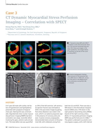 Clinical Results Cardio-Vascular 
Case 3 
CT Dynamic Myocardial Stress Perfusion 
Imaging – Correlation with SPECT 
Kheng-Thye Ho, FACC,* Kia-Chong Chua, MSC,* 
Ernst Klotz,** and Christoph Panknin,** 
*Department of Cardiology, Tan Tock Seng Hospital, Singapore, Republic of Singapore 
**Business Unit CT, Siemens Healthcare, Forchheim, Germany 
HISTORY 
A 61-year-old male with cardiac risk fac-tors 
of hypertension and hyerlipidemia 
presented with symptoms of atypical 
chest pain. Resting ECG was unremark-able. 
Dipyridamole-stress nuclear myocar-dial 
perfusion imaging (NMPI) had dem-onstrated 
a very large, reversible defect 
involving the apex, anterior wall and sep-tum. 
The total defect size was quantified 
1 
42 SOMATOM Sessions · November 2010 · www.siemens.com/healthcare-magazine 
1 CT dynamic stress MPI with SPECT 
correlation in the mid-ventricular short 
axis (1A) and the horizontal long axis 
view (1B). Stress are images in the 
upper quadrants, rest images below; 
CT perfusion to the left of the corre-sponding 
SPECT. 
2 Invasive angiography findings: 
Total occlusion of the proximal LAD 
and a 90% lesion in OM3 (2A, arrow), 
and 75% lesion in the RPDA branch 
of the otherwise normal RCA (2B, 
arrowhead). 
as 34% of the left ventricle. Left ventricu-lar 
ejection fraction was estimated as 
65% in the post-stress images by gating. 
Post-stress dilatation was noted in the 
scan, which is an adverse prognostic sign 
in the presence of coronary artery dis-ease. 
Invasive coronary angiography 
demonstrated total occlusion of the prox-imal 
LAD, with collaterals arising from 
both the LCx and RCA. There was also a 
90% lesion in the third obtuse marginal 
branch (OM3) and a 75% lesion in the 
right posterior descending artery (RPDA) 
branch of the right coronary artery 
(RCA). CT myocardial perfusion imaging 
(MPI) was performed prior to CABG.[1] 
The patient underwent successful coro-nary 
bypass surgery, with a left internal 
1A 1B 
2A 2B 
 